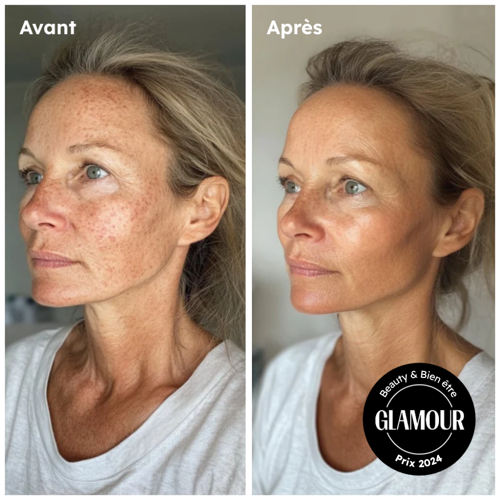 Change ton fond de teint pour ORA