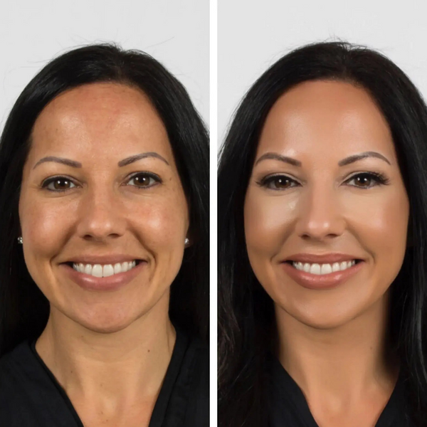 Avant / Après de Maria E.