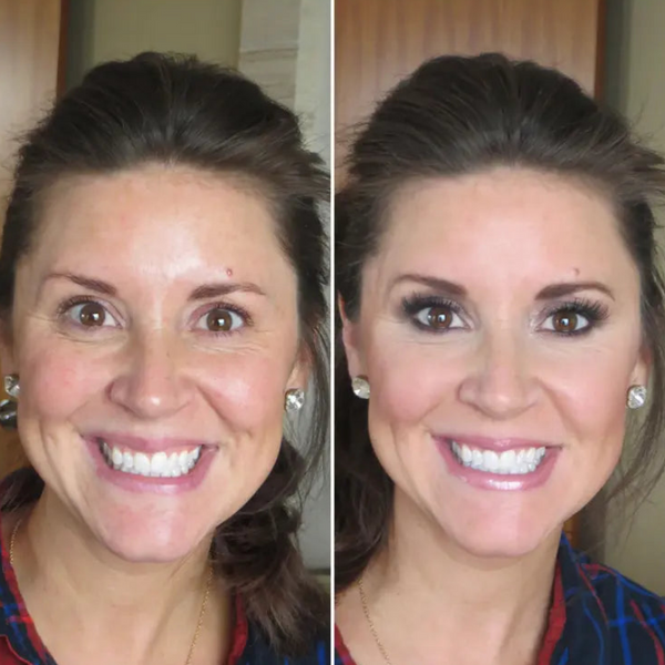 Avant / Après de Julie R.